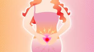 Many women have found success managing their endometriosis symptoms by eating and/or avoiding certain foods. Ø§Ù„Ø§Ù†ØªØ¨Ø§Ø° Ø§Ù„Ø¨Ø·Ø§Ù†ÙŠ Ø§Ù„Ø±Ø­Ù…ÙŠ Endometriosis Ù…Ø§Ø°Ø§ Ø§Ù„Ù†Ù‡Ø§Ø±