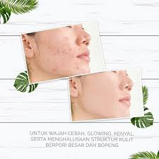 Pin Di Ms Glow Trenggalek