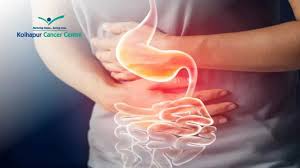 Image result for Constipation in Cancer
