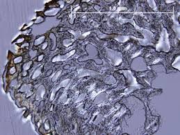 The significance of histological examination in the classification and diagnosis of clinical conditions is reliant on the expertise of the histology laboratory in managing the wide spectrum of specimen types submitted for analysis. Bone Histological Analysis Springerlink