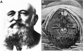 The Evolution of Pituitary Gland Surgery from the Ancients to the  Millennials