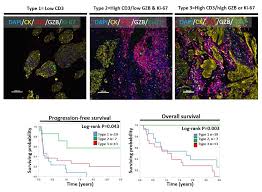 Juli 1952 in münchen) ist ein deutscher arzt und sozialwissenschaftler. 2020 Lung Cancer Highlight Predicting Response To Immune Checkpoint Inhibition In Non Small Cell Lung Cancer Lung Cancer Research Program Congressionally Directed Medical Research Programs