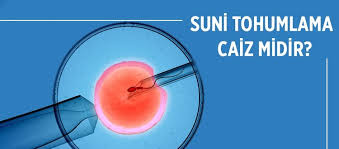 Suni Tohumlama Caiz Midir Islam A Gore Suni Tohumlama Nasil Olmalidir Suni Tohumlama Nedir Fikriyat Gazetesi