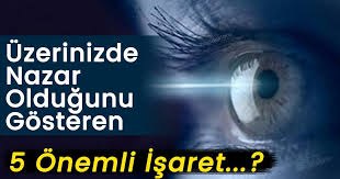 Uzerinizde Nazar Oldugunu Gosteren 5 Onemli Isaret 4 Ye Dikkat Saglik Paylasimlari Isaretler Psikoloji Bilgi