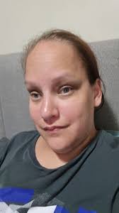 Introduction to Neurofibromatosis Support Group