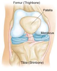 Image result for Patellar Tilt Test