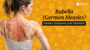 Image result for Rubella