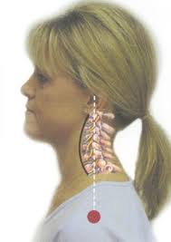 Forward Head Brochure