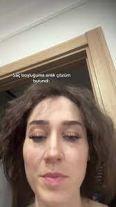 Saç Boşluğuma Anlık Çözüm Bulundu