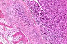 If ignored, or left untreated if ignored, or left untreated, canine lymphoma will grow quickly, and can generally kill a dog within 1 to 3 months after initial detection. Lymphoma Pet Cancer Society