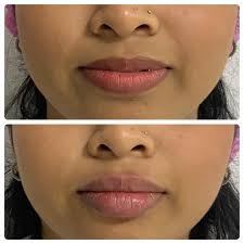 Dra Ingrid Cobos (@draingridcobos) • Instagram photos and videos