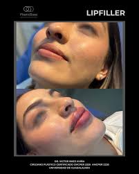 Muchas felicidades, Dr. Víctor Baez Aviña. Su dedicación, preparación y  compromiso con cada paciente son un verdadero ejemplo de excelencia médica.  Que sigan los éxitos.