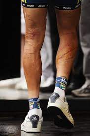 Julian alaphilippe springs a superb late attack to win stage one of the tour de france after two huge crashes in the closing stages. Pin On Bike Art