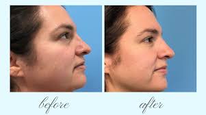 EVENTS — Holland Plastic Surgery & Aesthetics