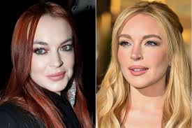Qué se hizo Lindsay Lohan en el rostro?