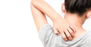 It occurs on areas of the body where in babies and adults with incontinence, intertrigo can show up as diaper rash. Intertrigo Hautwolf Ursachen Symptome Behandlung Kanyo