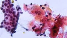 Cytology (Cytopathology): What It Is & Types