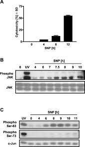 Join nubiles.net, the teen megasite that started it all! Jnk Dependent Phosphorylation Of C Jun On Serine 63 Mediates Nitric Oxide Induced Apoptosis Of Neuroblastoma Cells Journal Of Biological Chemistry