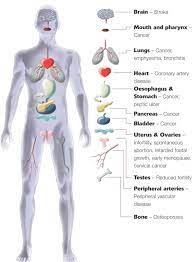 Is responsible for distinguishing between different kinds of pathogens and reacting to each noninfectious disease in which the body either secretes too little insulin or isn't able to use the insulin that it does secrete. Body Organ And Diseases Diagram Www Anatomynote Com Body Organs Human Body Organs Body Diagram