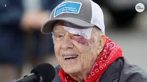 Jimmy was born at the wise sanitarium which is currently known as lillian g carter nursing center in plains, georgia. President Jimmy Carter Surgery For Brain Pressure What We Know