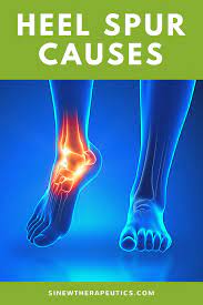 This Abnormal Extra Bone Growth Is In Response To Ligaments Tightening From Activities That Stress The Feet Heel Spurs Symptoms Heel Spurs Heel Spurs Treatment