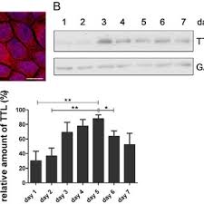 6 видео 20 105 просмотров обновлен 28 янв. Ttl Overexpression Depletes Detyrosinated Microtubules A Lysates Of Download Scientific Diagram