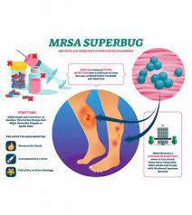 Mrsa, bacterium in the genus staphylococcus characterized by its resistance to the antibiotic mrsa is difficult to treat because of its resistance to most antibiotics. Mrsa In Children Causes Symptoms Treatment And Risks