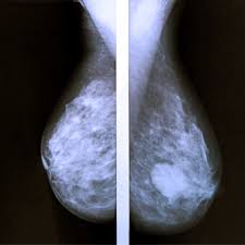 Read on for some hilarious trivia questions that will make your brain and your funny bone work overtime. What Questions Should I Ask My Doctor About Breast Cancer