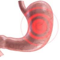 Maybe you would like to learn more about one of these? 5 Cara Cepat Redakan Asam Lambung