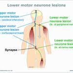 Pin On Ot Adult Rehab Ideas