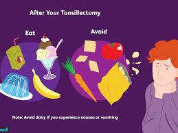 What Can I Eat After A Tonsillectomy