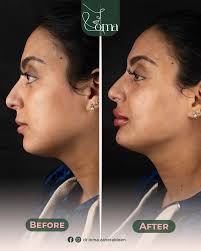 د.لُمى زهر الدين...