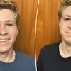 26 how much is it to remove wisdom teeth in south africa collection popular. 1