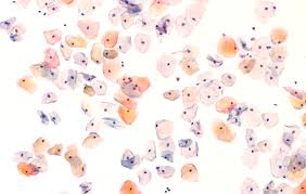 Image result for Pap Smear