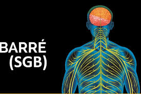 The diagnosis relies heavily on the clinical impression obtained from the history and examination, although. Guillain Barre De Donde Viene El Nombre Del Sindrome Que Mantiene En Alerta Al Peru Noticias Agencia Peruana De Noticias Andina