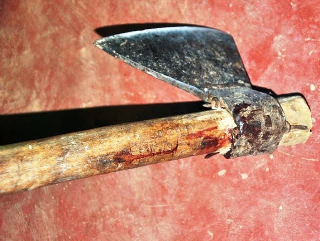 Resultado de imagem para lesão com machado ilustração"