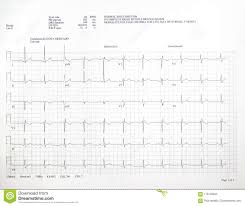 Close Up Ekg Heart Beat Test Stock Photo Image Of Cardiac