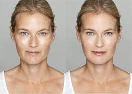 Chemische peelings gelten als besonders effektive behandlung,. Aha Peeling Mit Glycolsaure Profiheimbehandlung Selber Machen