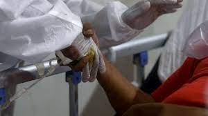 Dies sind späte symptome mit einer schlechten prognose und normalerweise folgt ein bewusstseinsverlust. Indien Schwarzer Pilz Zerfrisst Corona Patienten Premierminister Warnt Vor Weiterer Todlicher Krankheit Welt