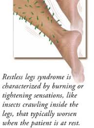 Image result for Restless Leg Syndrome