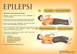 Penyakit jangkitan sifilis merebak dalam tiga peringkat. Punca Penyakit Sawan Dan Epilepsi
