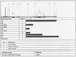 Das R O Special Borreliose Und Pseudo Borreliose Teil 2 Diagnose Der Borreliose Rheuma Online