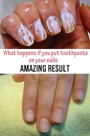 Toothpaste On Your Nails Jpg 600 900 You Nailed It Nails Body Care
