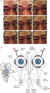 Image result for Extraocular Movement