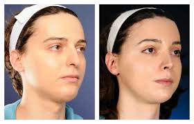 Doctors Plastic Surgery 14 Plastic Surgery Reconstructive Surgery Plastic And Reconstructive Surgery