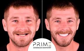 Prime Advanced Dentistry