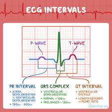 Image result for QT Interval