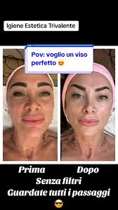 Elena Giirdano Trattamento Viso