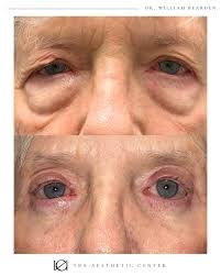 The Aesthetic Center at Virginia Eye Institute