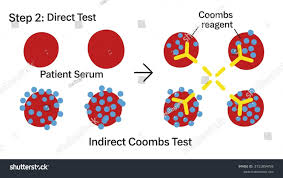 Image result for Indirect Coombs